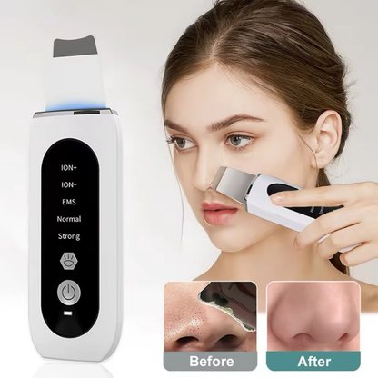 NEW UPGRADED Ultrasonic Face Scrubber